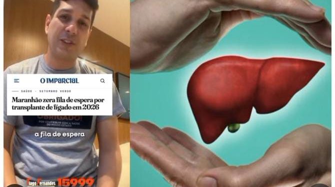 Do último lugar à fila zerada no transplante de fígado: Tiago Fernandes propõe ampliar política de transplantes no Maranhão